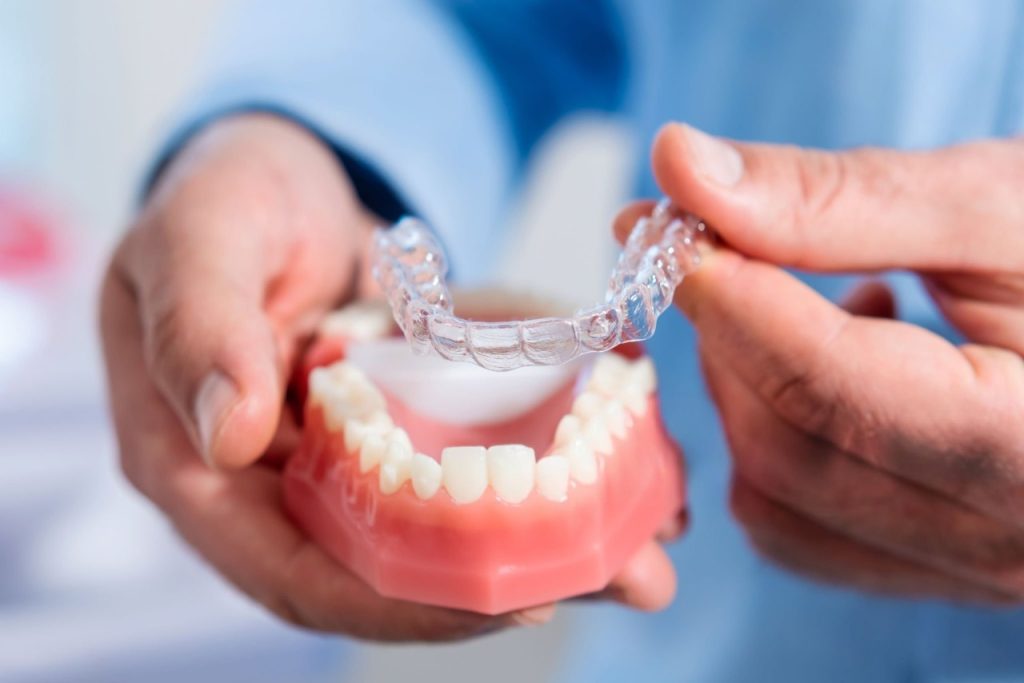 Gutiere aligner