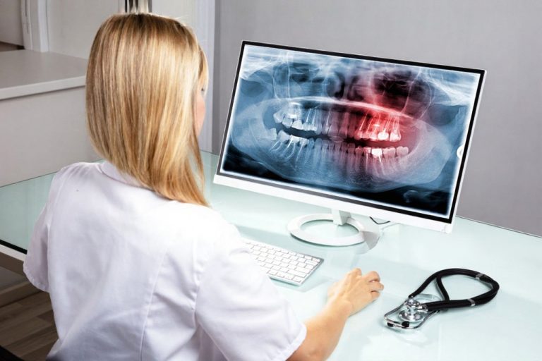 Ce este o radiografie dentara?