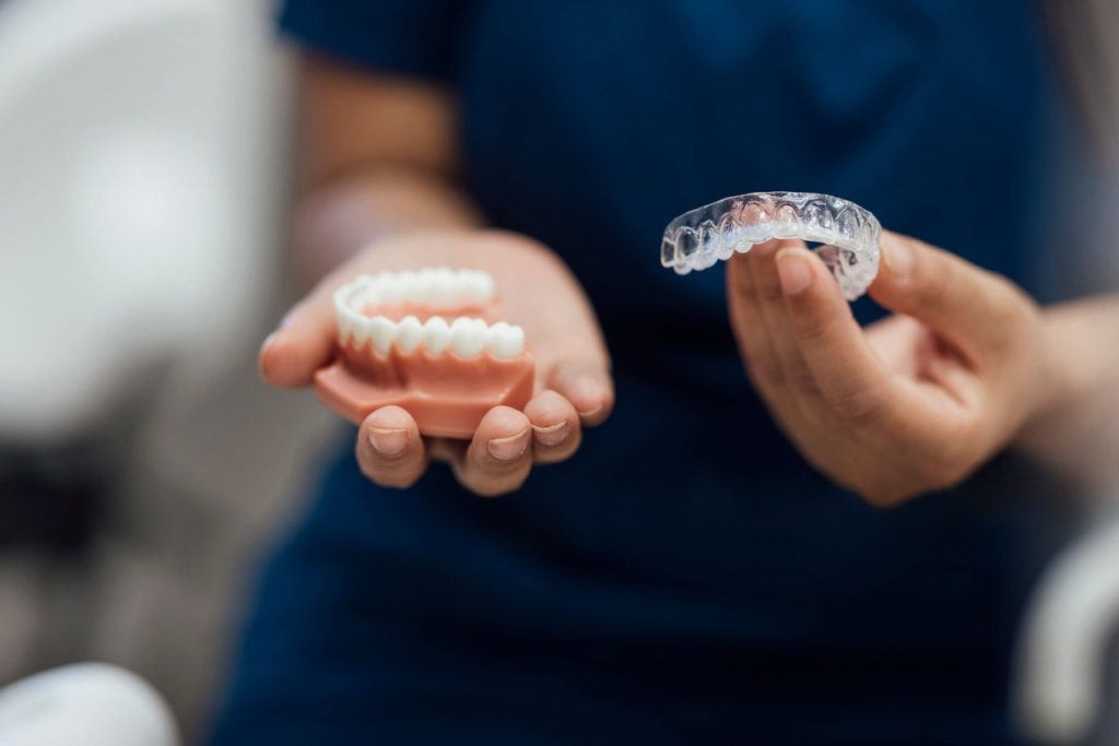 aparat clear aligner VelvetDental