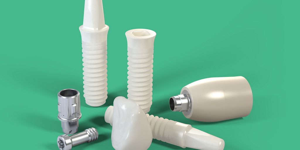 implant straumann