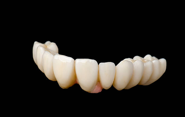 coroane zirconiu