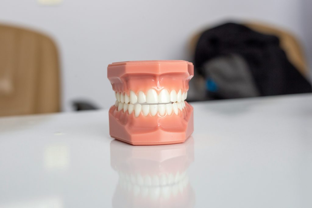 avantaje aparat dentar ceramic fix