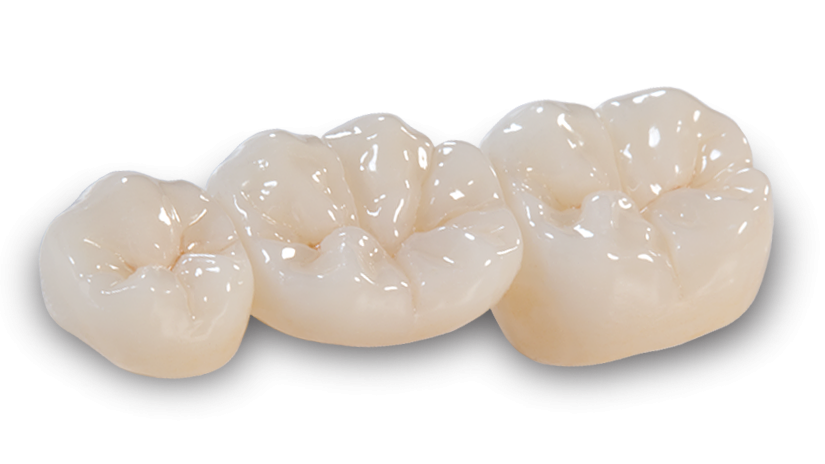 Clinica Stomatologica Velvet Dental Totul despre coroanele integral zirconiu 