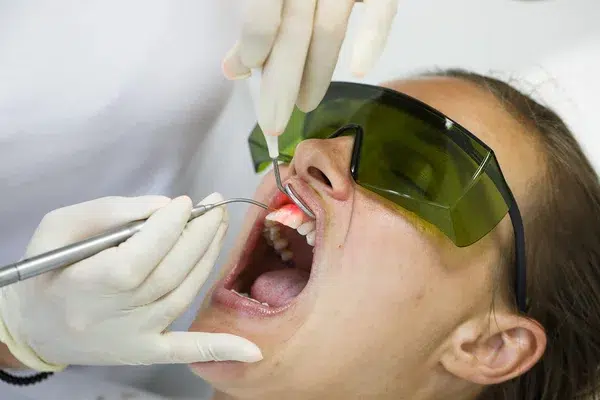 tratament parodontal laser