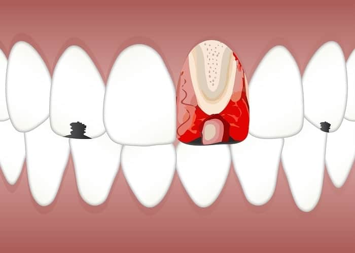 pulpita dentara bucuresti