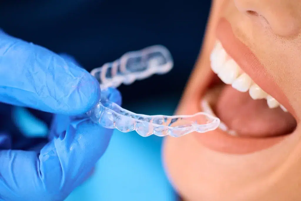 invisalign