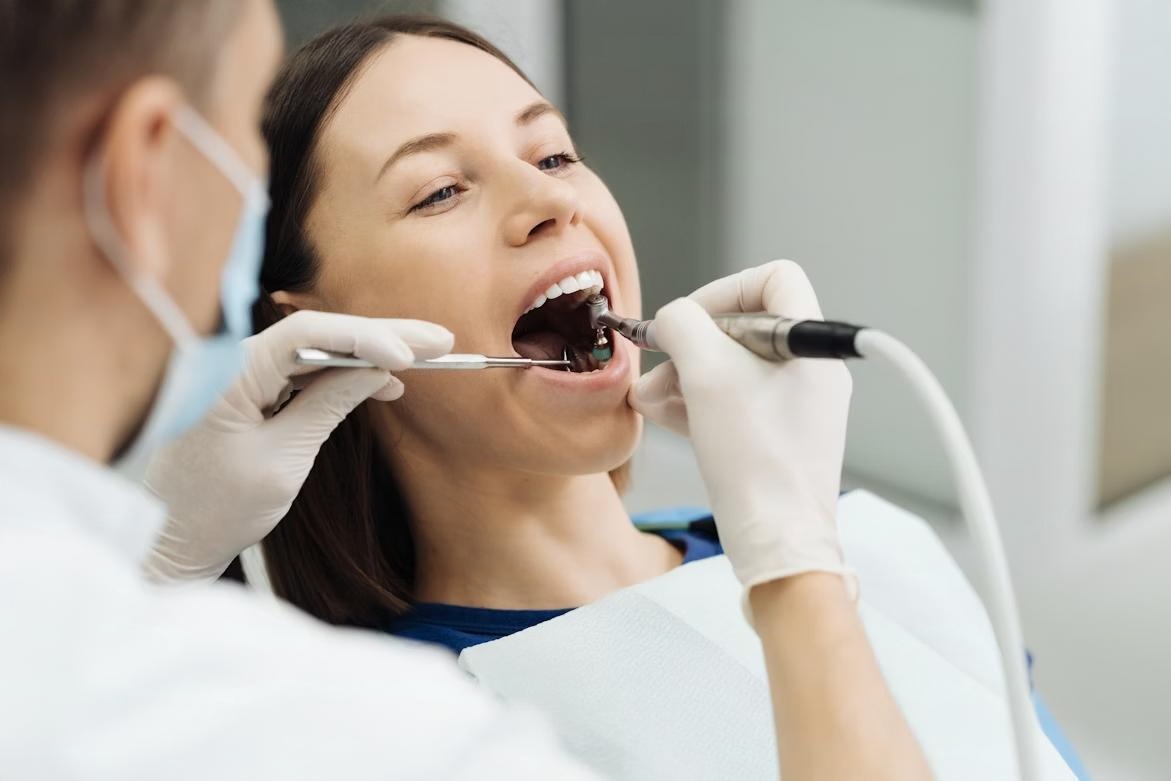 Igienizare dentara profesionala