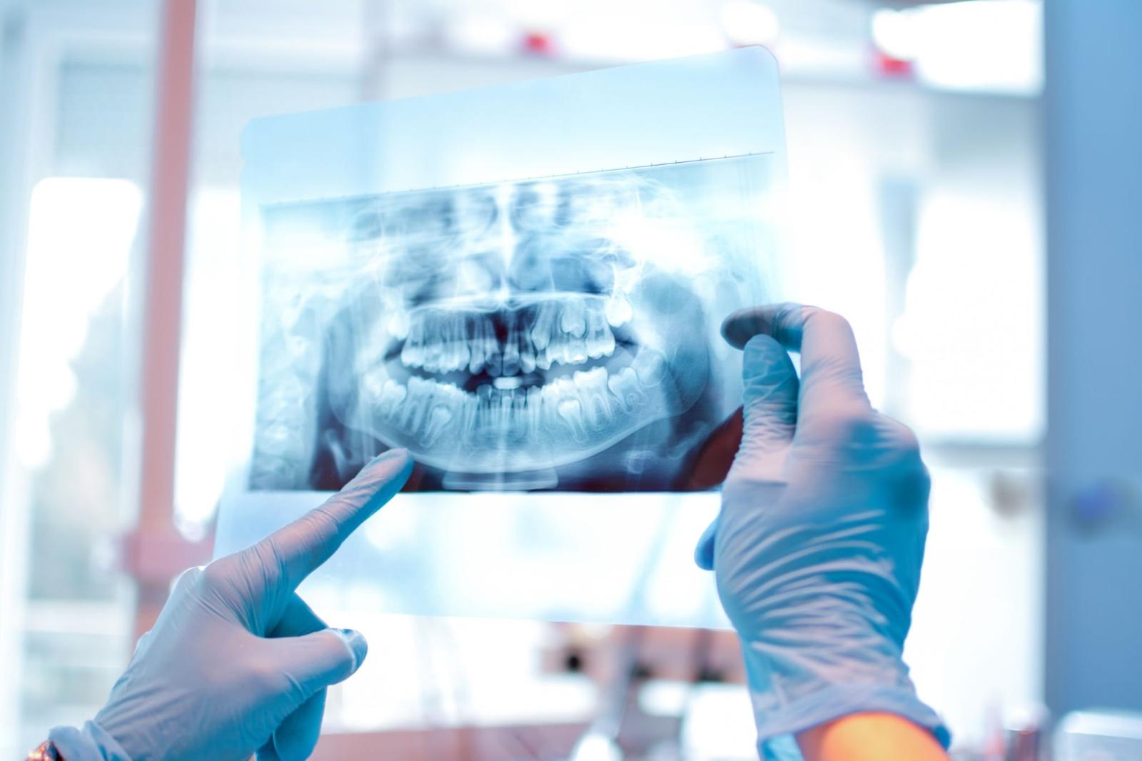radiologie dentara Bucuresti