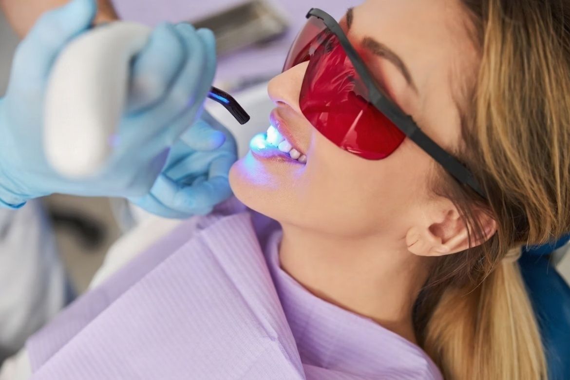 tratament albire dentara laser zoom