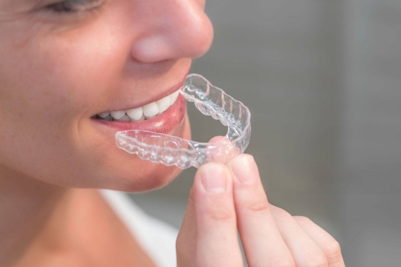 tratament cu Clear Aligner