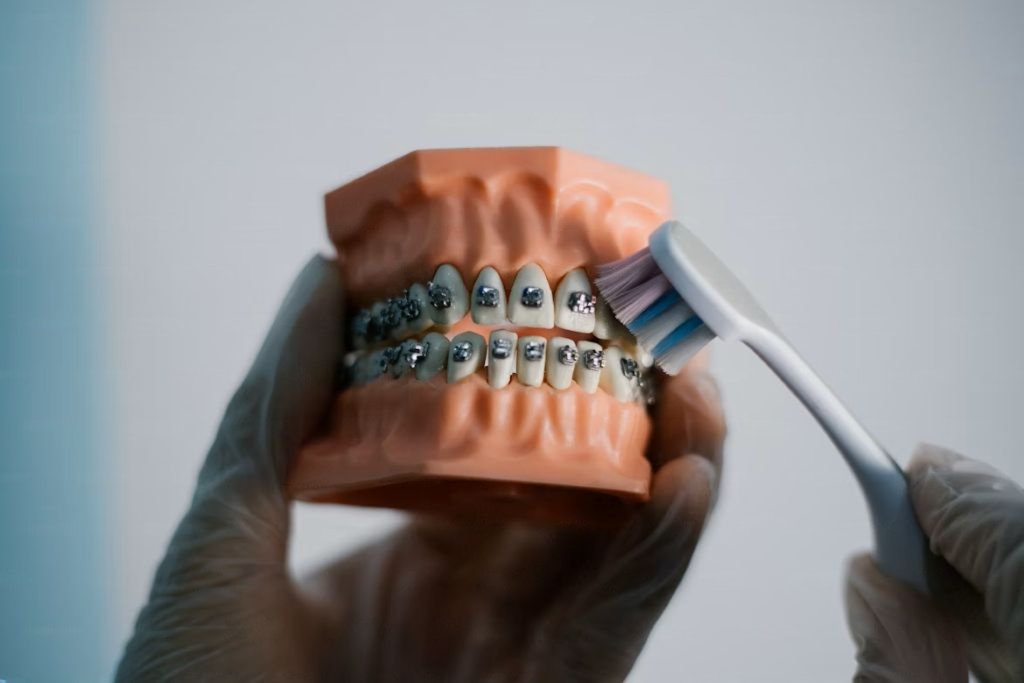 ingrijire aparat denatr metalic