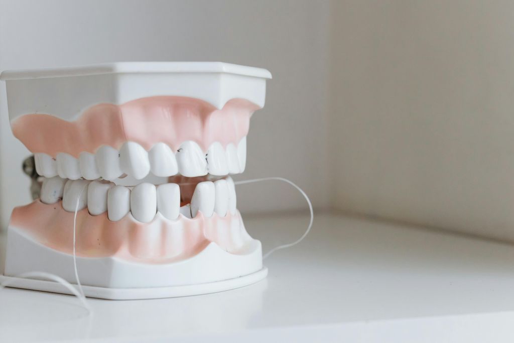 Cum întreții corect fațetele dentare