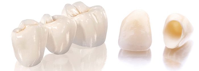 coroane dentare sector 1
