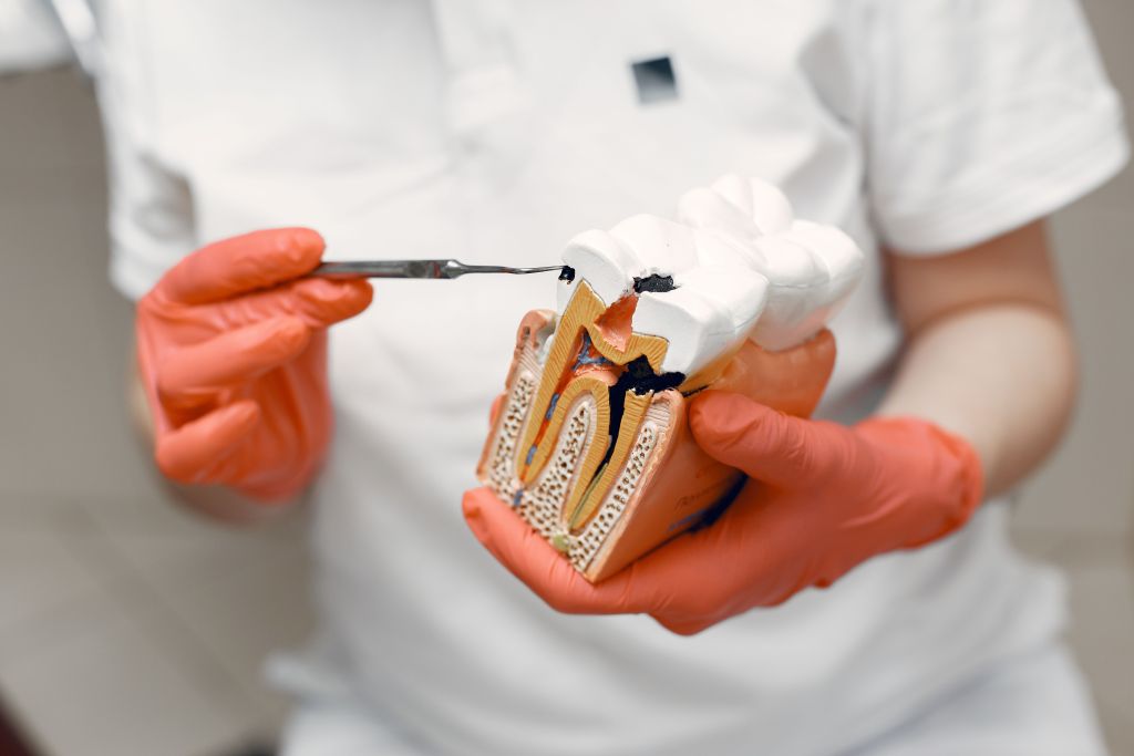 cand ai nevoie de tratament endodontic